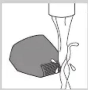 Simple line drawing of a medical procedure with a shaded area and tubing (no text or symbols)