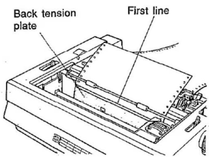 Back tension plate First line