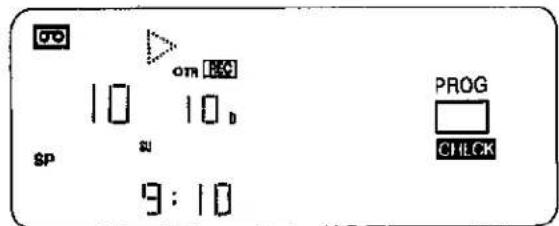 SP 10 10 b su 9:10 tri om [80] PROG CHECK