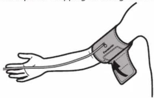Illustration d'un avant-bras humain avec un dispositif à bande attaché, sans texte ni symbole.
