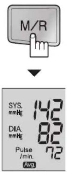 M/R SYS mmHg 142, DIA mmHg 82, Pulse /min Moy. 72