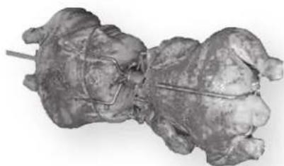 3D rendered anatomical model of a biological structure, possibly a muscle or organ, with no visible text or labels.