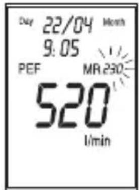 Day 22/04 Month 9:05 PEF MR 230 520 1/min