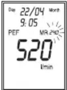Day 22/04 Month 9:05 PEF MR 240 520 1/min