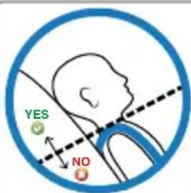 YES NO