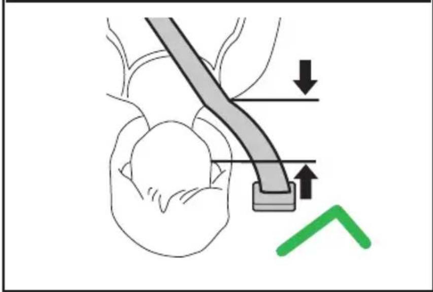 Medical diagram showing a catheter insertion procedure with directional arrows and a green arrow indicating movement or change.