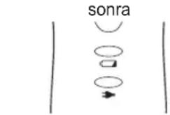 sonra