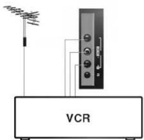 VCR