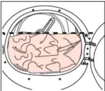 Diagram of a biological or medical procedure inside a circular chamber, showing internal tissue and a tool interacting with it (no text or labels present)