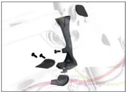 Medical illustration of a human hip joint with surgical hardware (no text or labels)