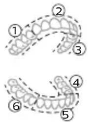 Diagram showing dental arch anatomy with numbered labels for different tooth positions or regions