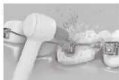 PANASONIC EW1614 - Orthodontisch spuitstuk - 1