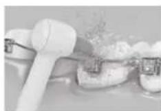 PANASONIC EW1614 - Orthodontische Düse - 1