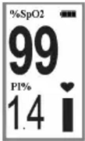 %SpO2 99 PI% 1.4 i