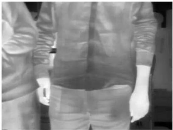 Person wearing a full-body medical gown with visible surgical bandages and gloves (no text or symbols)