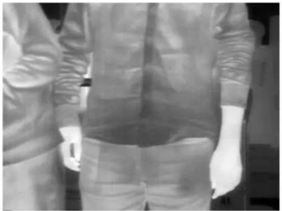 Person wearing a full-body medical gown with visible surgical bandages and gloves (no text or symbols)