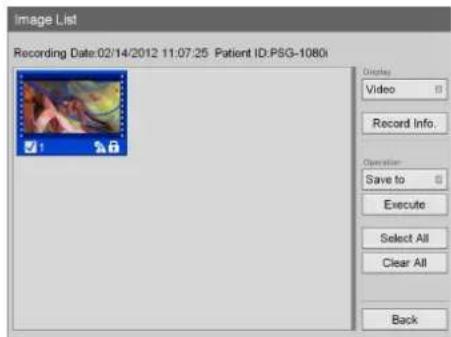 Image List Recording Date:02/14/2012 11:07:25 Patient ID:PSG-1080i Video Record Info. Operation: Save to Execute Select All Clear All Back