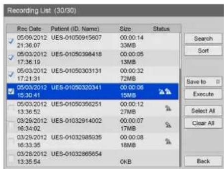 Recording List (30/30) Rec Date Patient (ID. Name) Size Status 05/09/2012 UES-01050915607 00:00:14 21:36:07 33MB 05/03/2012 UES-01050398418 00:00:05 17:36:19 13MB 05/03/2012 UES-01050303131 00:00:32 17:21:31 72MB 05/03/2012 UES-01050320341 00:00:06 15:30:41 15MB 05/03/2012 UES-01050356251 00:00:12 1…