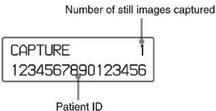 Number of still images captured CAPTURE 1 1234567890123456 Patient ID
