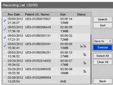 Recording List (30/30) Rec Date Patient (ID, Name) Size Status 05/09/2012 UES-01050915607 00:00:14 21:36:07 33MB 05/03/2012 UES-01050398418 00:00:05 17:36:19 13MB 05/03/2012 UES-01050303131 00:00:32 17:21:31 72MB 05/03/2012 UES-01050320341 00:00:06 15:30:41 15MB 05/03/2012 UES-01050356251 00:00:12 1…
