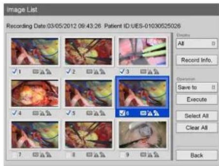 Image List Recording Date:03/05/2012 09:43:26 Patient ID:UES-01030525026 ✓ 1 ✓ 2 ✓ 3 ✓ 4 ✓ 5 ✓ 6 ✓ 7 ✓ 8 ✓ 9 Location All Record Info. Operation Save to Execute Select All Clear All Back