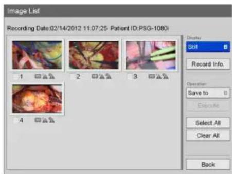 Image List Recording Date:02/14/2012 11.07:25 Patient ID:PSG-1080 1 2 3 4 Still Record Info. Operation: Save to Exposure Select All Clear All Back