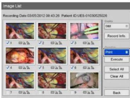 Image List Recording Date: 03/05/2012 09:43:26 Patient ID: UES-01030525026 Display Still Record Info. Print Execute Select All Clear All Back