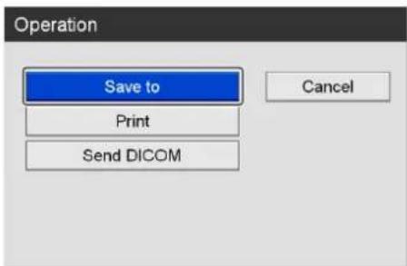 Operation Save to Print Send DICOM Cancel