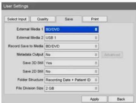 User Settings Select Input Quality Save Print External Media 1 BD/DVD External Media 2 USB 1 Record Save to Media BD/DVD Metadata Output No Save 3D Still Yes Save 2D Still No Folder Structure Recording Date + Patient ID File Division Size 2 GB Apply Back
