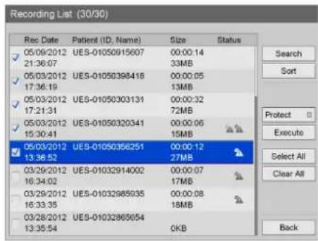 Recording List (30/30) Rec Date Patient (ID. Name) Size Status 05/09/2012 UES-01050915607 00:00:14 21:36:07 33MB 05/03/2012 UES-01050398418 00:00:05 17:36:19 13MB 05/03/2012 UES-01050303131 00:00:32 17:21:31 72MB 05/03/2012 UES-01050320341 00:00:06 15:30:41 15MB 05/03/2012 UES-01050356251 00:00:12 1…