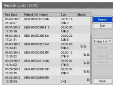 Recording List (30/30) Rec Date Patient (ID, Name) Size Status 05/09/2012 UES-01050915607 00:00:14 21:36:07 33MB 05/03/2012 UES-01050398418 00:00:05 17:36:19 13MB 05/03/2012 UES-01050303131 00:00:32 17:21:31 72MB 05/03/2012 UES-01050320341 00:00:06 15:30:41 15MB 05/03/2012 UES-01050356251 00:00:12 1…