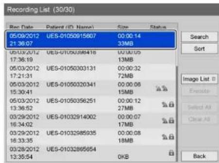 Recording List (30/30) Rec Date Patient (ID Name) Size Status 05/09/2012 UES-01050915607 00:00:14 21:36:07 33MB 05/03/2012 UES-0105098418 00:00:05 17:36:19 13MB 05/03/2012 UES-01050303131 00:00:32 17:21:31 72MB 05/03/2012 UES-01050320341 00:00:06 15:30:41 15MB 05/03/2012 UES-01050356251 00:00:12 13:…