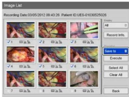 Image List Recording Date:03/05/2012 09:43:26 Patient ID:UES-01030525026 Country All Record Info. Save to Execute Select All Clear All Back