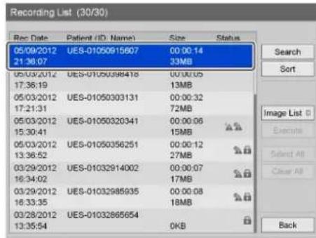 Recording List (30/30) Rec Date Patient ID Name Size Status 05/09/2012 UES-01050915607 00:00:14 21:36:07 33MB 05/03/2012 UES-0105098418 00:00:05 17:36:19 13MB 05/03/2012 UES-01050303131 00:00:32 17:21:31 72MB 05/03/2012 UES-01050320341 00:00:06 15:30:41 15MB 05/03/2012 UES-01050356251 00:00:12 13:36…