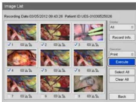 Image List Recording Date:03/05/2012 09:43:26 Patient ID:UES-01030525026 Display: All Record Info. Operation: Print Execute Select All Clear All Back
