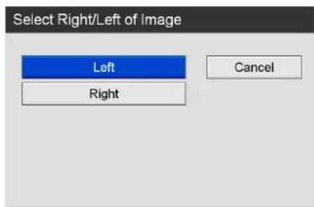 Select Right/Left of Image Left Right Cancel
