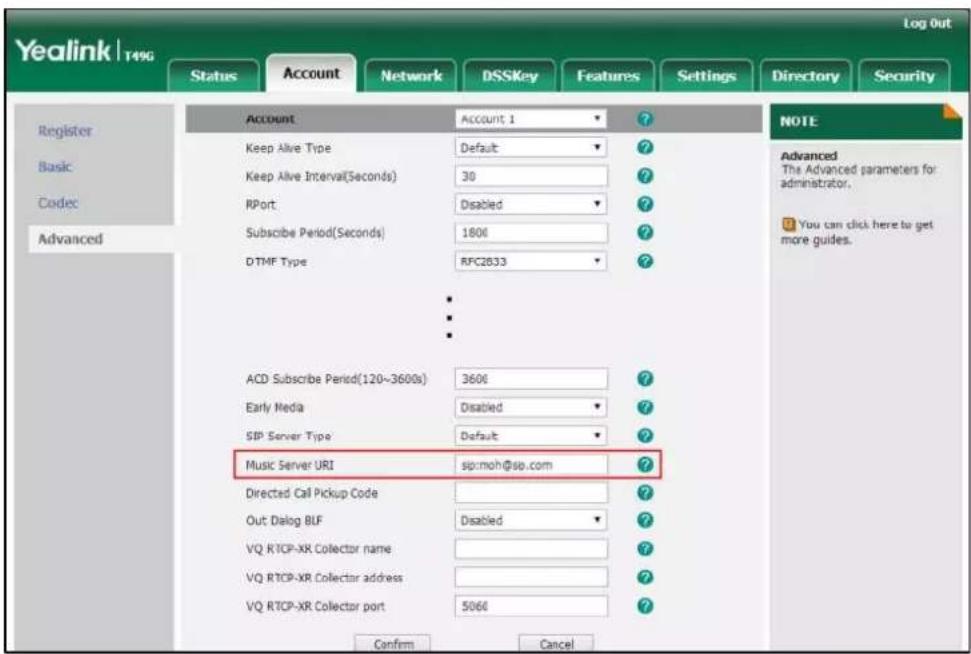 Yealink | T496 Log Out Status Account Network DSSKey Features Settings Directory Security Register Basic Codec Advanced Account Account 1 ? ? Keep Alive Type Default ? Keep Alive Interval(Seconds) 30 ? RPort: Disabled ? Subscribe Period(Seconds) 1806 ? DTMF Type RFC2833 ? ACD Subscribe Period(120~36…