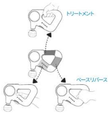 graph TD A["トリートメント"] --> B["ベースリバース"] B --> C["操作区域"] C --> D["操作区域"]
