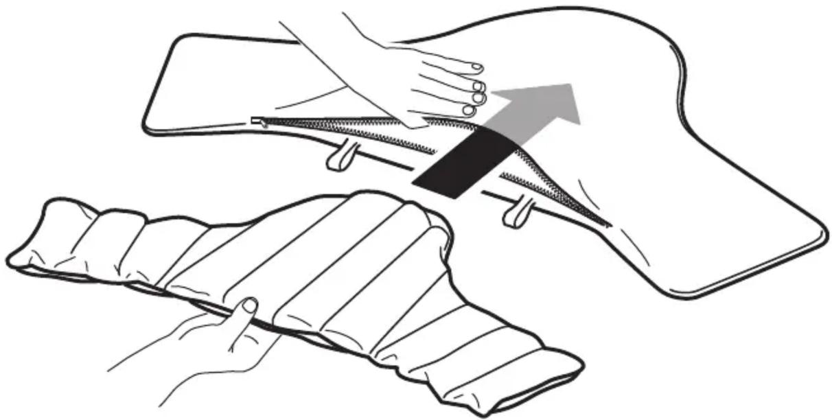 Illustration d'une procédure médicale montrant le placement des mains sur un instrument chirurgical et le clampage d'un tissu (sans texte ni symboles).