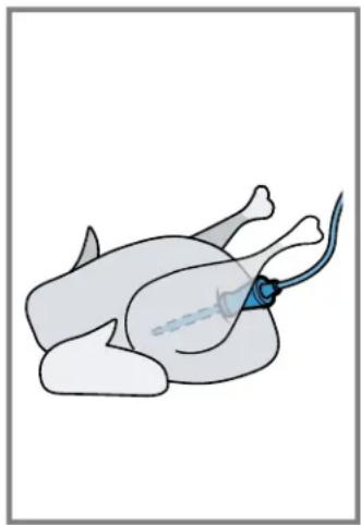 Illustration of a person lying down with a medical catheter inserted, no text or symbols present