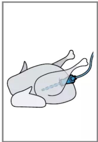 Illustration of a person lying down with a medical catheter inserted (no text or symbols)