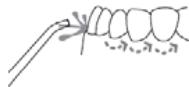 Simple line drawing of a tooth with a pointed tip and a dashed line indicating a specific point (no text or symbols)