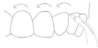 Simple line drawing of a tooth with arrows indicating direction (no text or symbols)