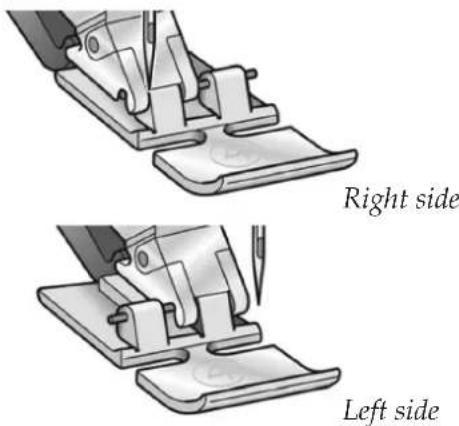 Right side Left side