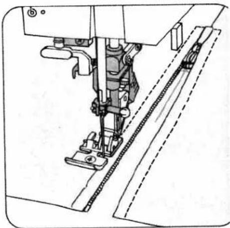 Technical line drawing of a sewing machine needle and chain (no text or symbols)
