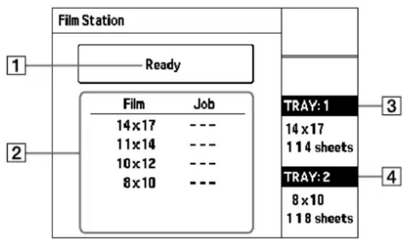 Film Station Ready 1 2 Film Job 14x17 --- 11x14 --- 10x12 --- 8x10 --- TRAY: 1 14 x 17 114 sheets TRAY: 2 8 x 10 118 sheets 3 4