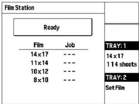 Film Station Ready Film Job 14 x 17 --- 11 x 14 --- 10 x 12 --- 8 x 10 --- TRAY: 1 14 x 17 1 14 sheets TRAY: 2 Set Film