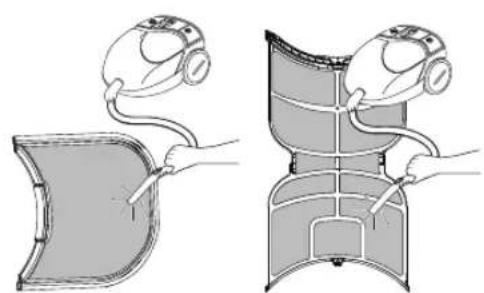 Illustration of two different medical or surgical procedures with surgical devices and tubing (no text or symbols)