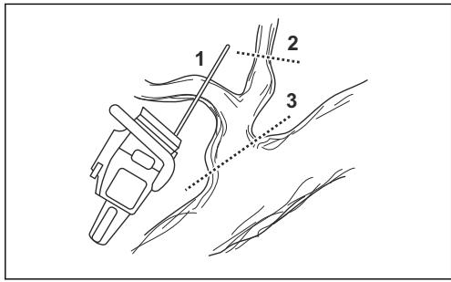 HUSQVARNA 555 - Technika odvětvování - 3